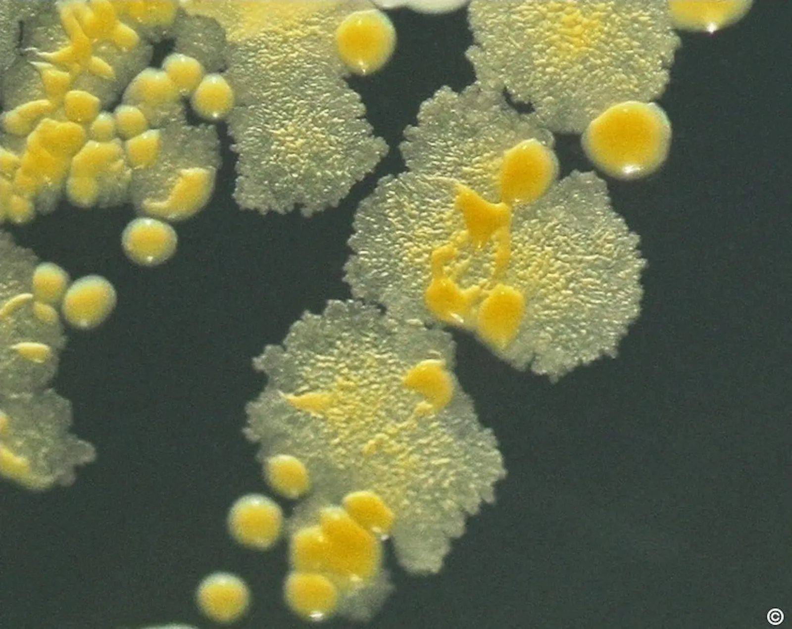 Week 22: Mycobacterium vaccae, Jenifer Wightman, Graham A.W. Rook